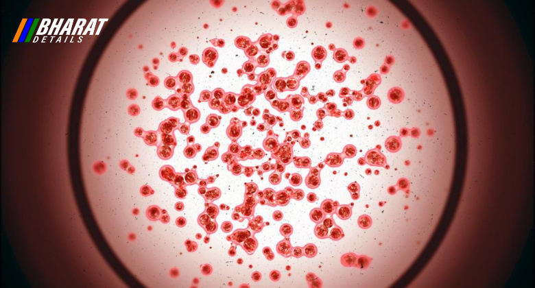 Leukemia Cancer